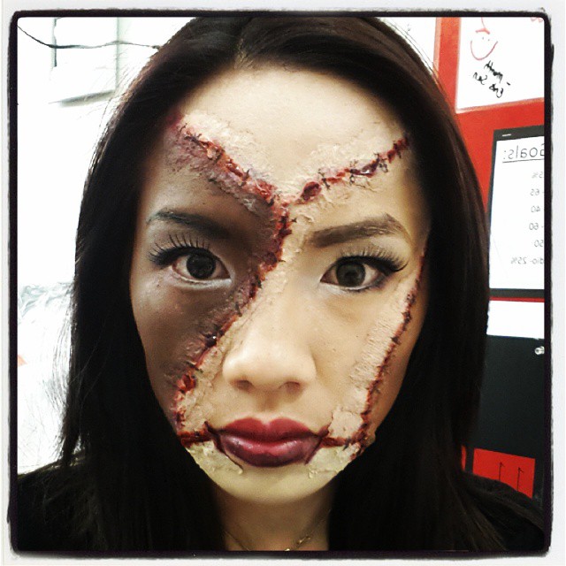 Plastic Surgery Gone Wrong Stitched Face